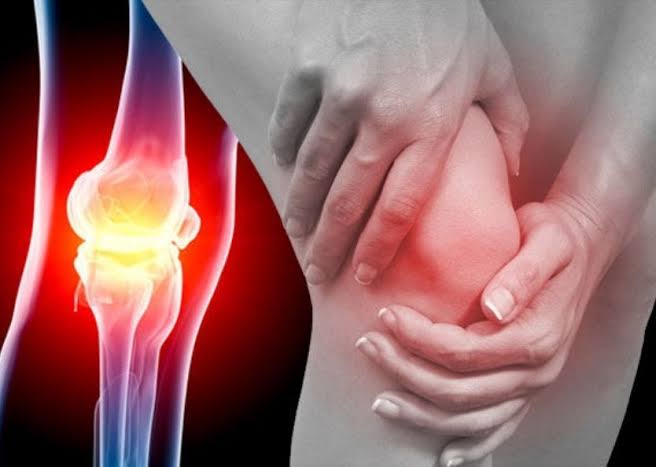 ข้อเข่าเสื่อม (Osteoarthritis Of The Knee)